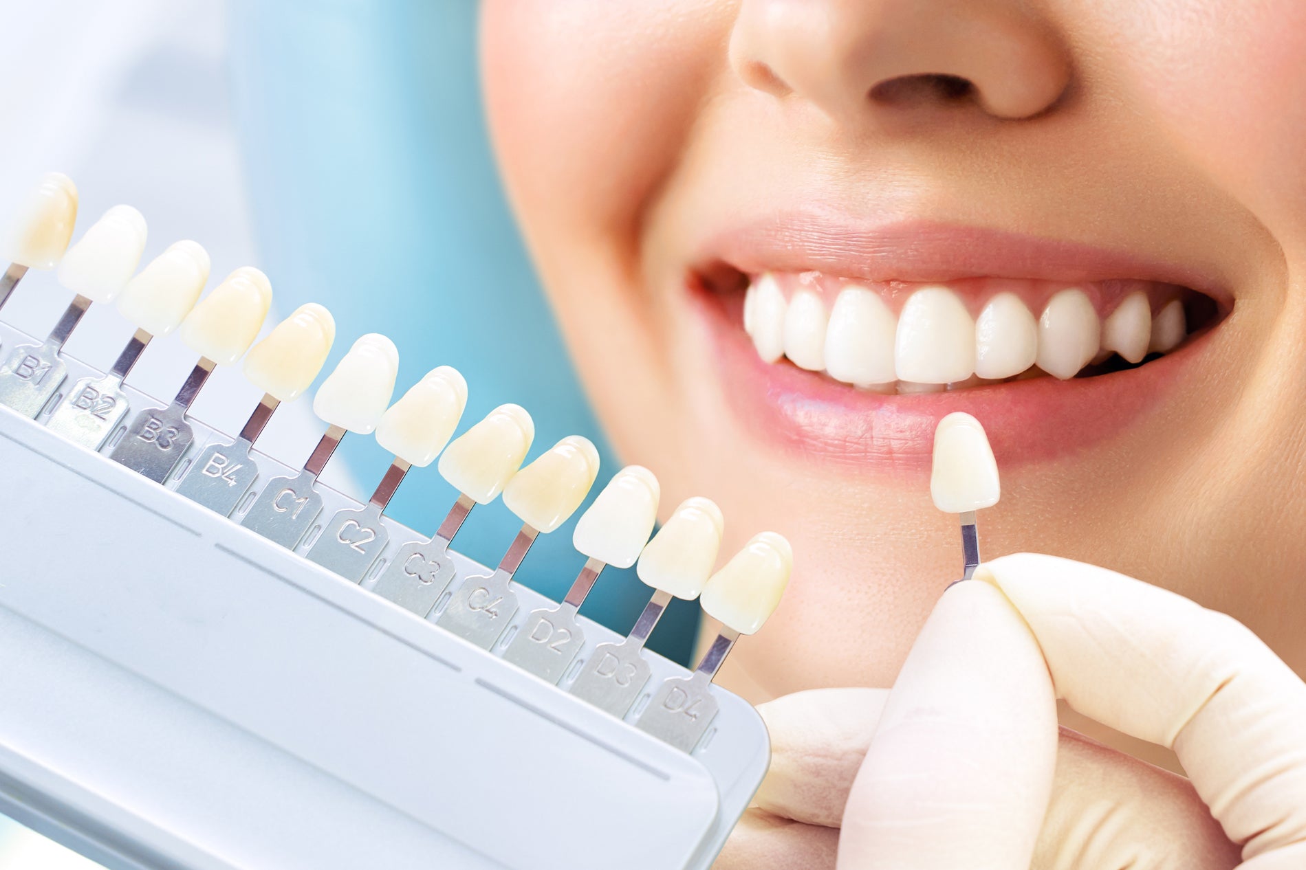 Richmond, BC, Teeth Whitening Services